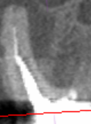 Tooth 3D Image 2