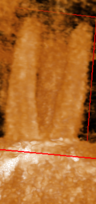 Tooth 3D Image 3